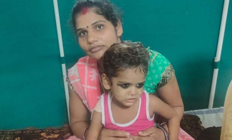 डेढ़ किलो की गठान का दर्द एक साल से झेल रहा था 2 साल का कार्तिक: मेडिकल अस्पताल में हुआ सफल ऑपरेशन 1 WhatsApp Image 2021 08 10 at 12.02.57