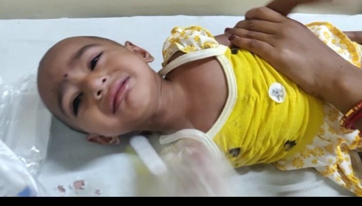 13 माह की बच्ची की सांस नली में फंस गई मिर्ची: 6 दिन से तड़प रही थी, मेडिकल में ऑपरेशन से निकाला गया मिर्ची का टुकड़ा 1 WhatsApp Image 2021 08 12 at 14.15.00