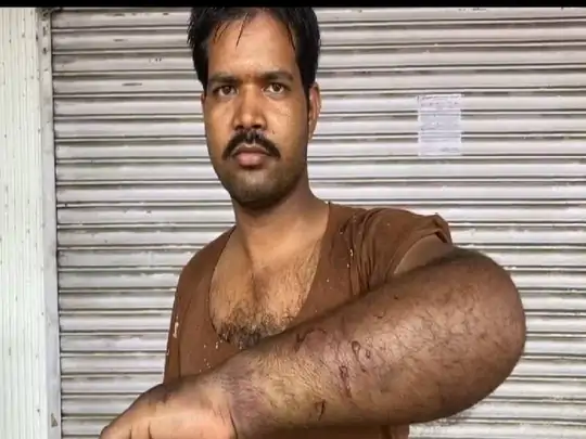 SP पर सिपाही के साथ मारपीट आरोप:आपत्तिजनक हरकत की शिकायत पर 22 सितंबर को SP ने किया था निलंबित, 4 दिन बाद शरीर में लगी चोट दिखाते थाने पहुंचा 1 sipahi111 1632653193