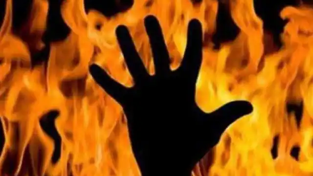 बहन से छेड़छाड़ का बदला घर मेें आग लगाकर लिया : रोज-रोज की प्रताडऩा से तंग थे परिजन, शोहदा गिरफ्तार 1 burn man 1612115459