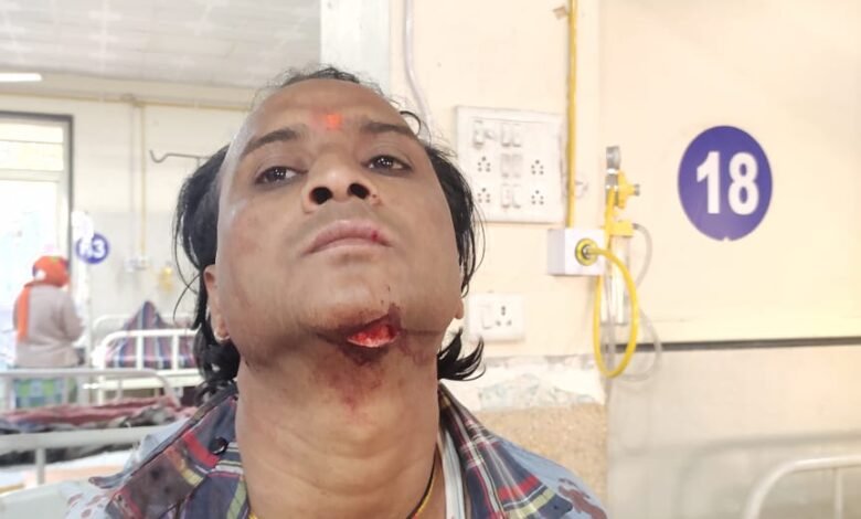 गोरखपुर में भाई ने भाई को घोंप दी चाकू : घरेलु विवाद का बदला पान की दुाकन में लिया, गर्दन में मारा चाकू 1 WhatsApp Image 2021 12 06 at 11.56.22 AM