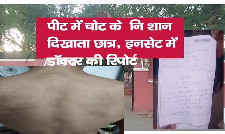 पं-लज्जा शंकर झा स्कूल का टीचर बना जल्लादः दो बच्चों को बुरी तरह से पीटा, पूरे शरीर में निशान बने 1 20 copy