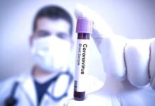 दमोह में आज 96 कोरोना पॉजिटिव केस आये 10 corona1