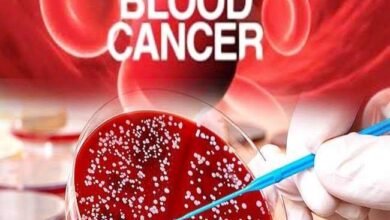 07 12 2019 blood cancer 19822960