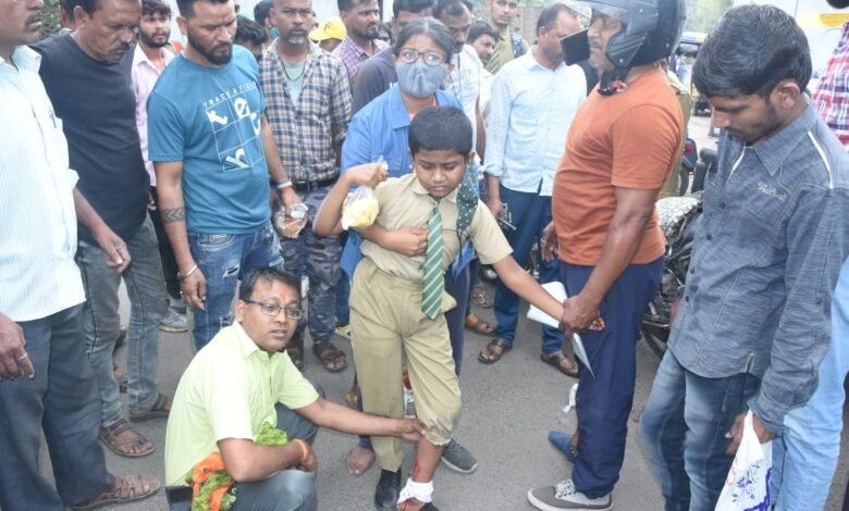 नगर निगम के सफाई ट्रक ने बाइक को मारी टक्कर : मासूम बुरी तरह घायल 1 WhatsApp Image 2022 03 25 at 11.47.50 AM