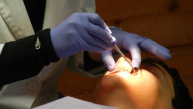 mouth surgery large 1816 21