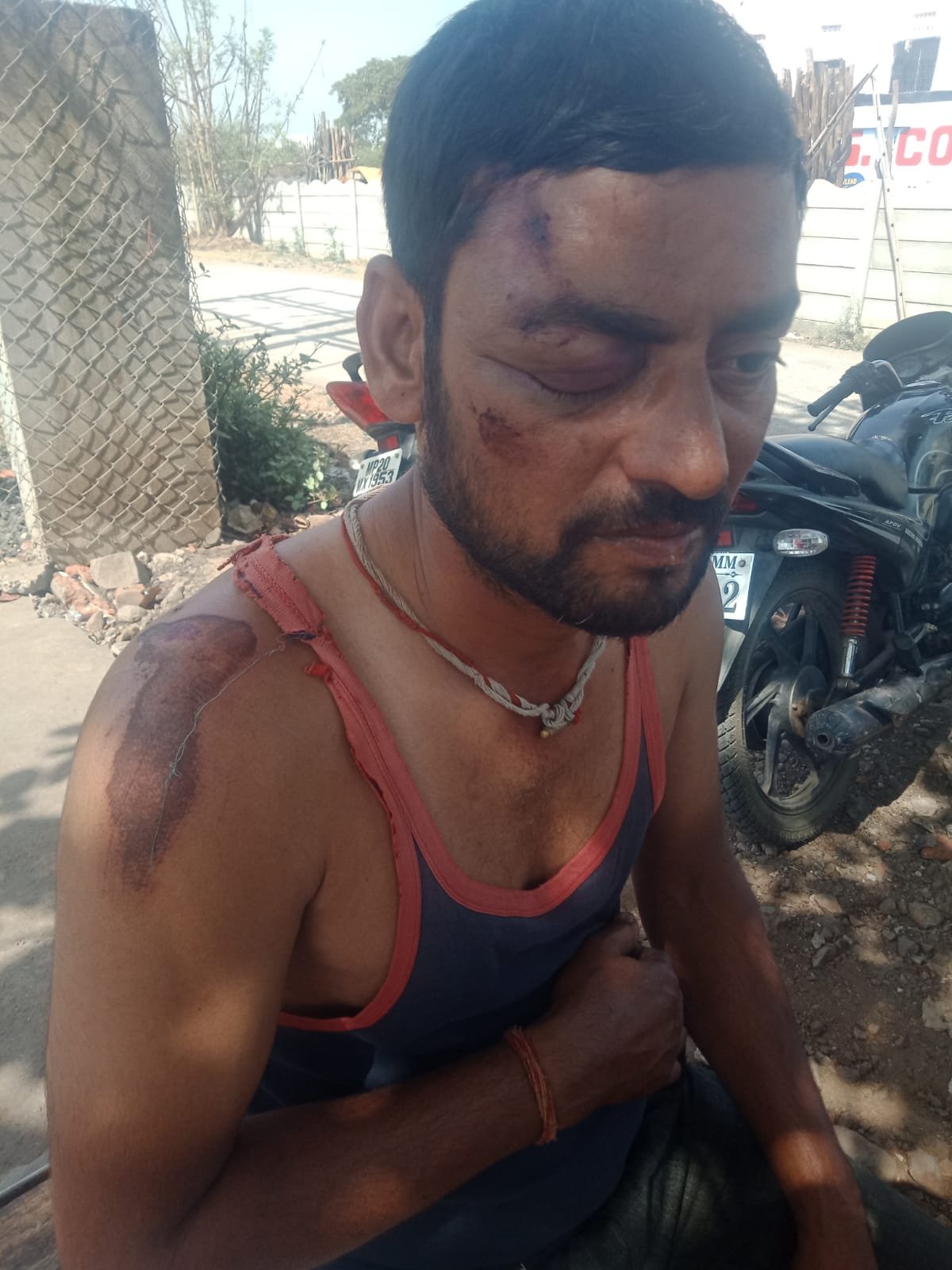 मझौली में दर्दनाक हादसा : सूअर से टकराई बाइक, एक की मौत दूसरा गंभीर 2 WhatsApp Image 2022 04 25 at 11.11.52 AM