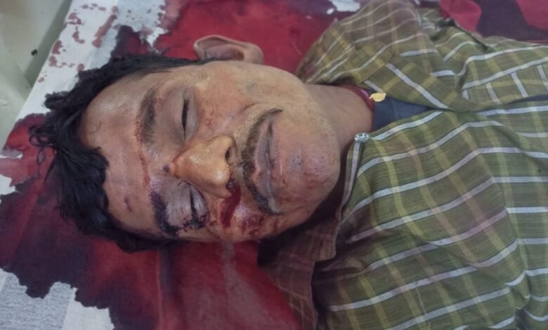 मझौली में दर्दनाक हादसा : सूअर से टकराई बाइक, एक की मौत दूसरा गंभीर 1 WhatsApp Image 2022 04 25 at 11.11.53 AM