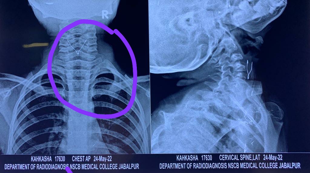 82e9efdb 764a 497b bbb9 58e920de0cec