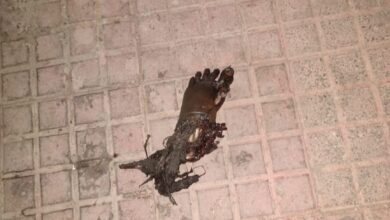 रेल इंजन में फं सकर जबलपुर पहुंचा कटा पैर: जीआरपी ने पहुंचाया मेडिकल 9 WhatsApp Image 2022 05 22 at 11.40.31 AM