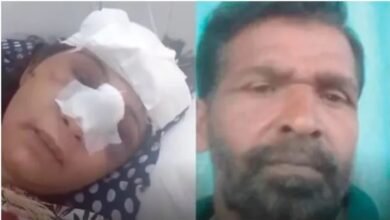 हथौड़ा मारकर पत्नी का मुंह फोड़ा:महिला बोली- जवान बेटी-बेटे को मारता था; बेटी ने कहा- ऐसा पिता नहीं चाहिए 8 Untitled 24