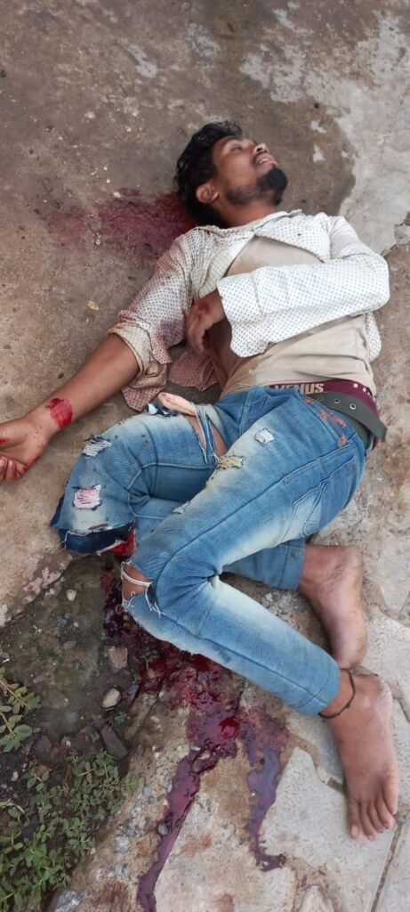 बच्चों की मौत की खबर देकर लौट रहे युवक की मौत, दूसरा गंभीर : मृतक का एक पैर कटकर दूर गिरा, दो किमी घिसट गयी बाइक 3 WhatsApp Image 2022 06 22 at 1.03.23 PM