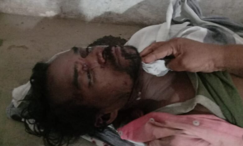 गौर के पड़रिया पुल के नीचे बेहोशी की हालत में मिला युवक, मौत : पुलिस जुटी जांच में, क्षेत्र में हड़कंप 1 WhatsApp Image 2022 07 16 at 8.33.38 AM