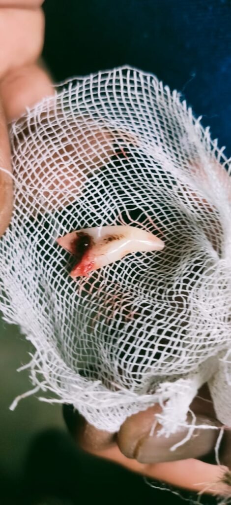 JABALPUR NEWS- सिहोरा के बनखेड़ी -इंद्राना गांव में घुसा खून से लथपथ तेंदुआ : जबड़े में गंभीर चोट, दांत टूटा, वेटरनरी में भर्ती ... देखे.. वीडियो... 2 bdeafcaa ce0c 4589 bc30 1fab035efcab