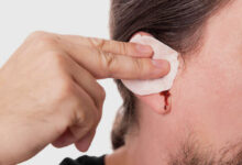 ear bleeding Large