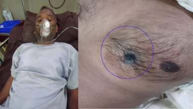 जबलपुर में सिविल कांट्रेक्टर ने खुद को सीने में गोली मारीः परिवार से बिजनेस में लाॅस के चलते उठाया कदम ...देखे.. वीडियो... 8 250