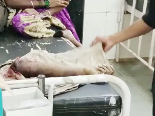 बाइक की चाबी नहीं देने पर बेटे का हाथ काटा : कटा हाथ लेकर थाने पहुंचा पिता 1 6 1659620784