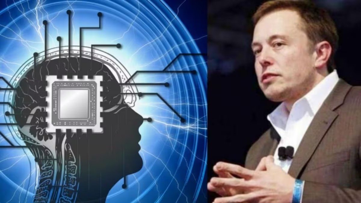 अब लोगों के दिमाग में चिप लगाने की तैयारी कर रहे Elon Musk,की न्यूरालिंक तैयार कर रही तकनीक जाने पूरी डिटेल्स 4 3d3771e3 c110 4dce 9d6c 2960d4b0d76e