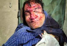 मदन महल में ट्रेन से टकराया युवक,मृतक अज्ञात. जीआरपी पड़ताल में जुटी 10 6bc53062 6b01 4bbf ac88 e9c214003e7d