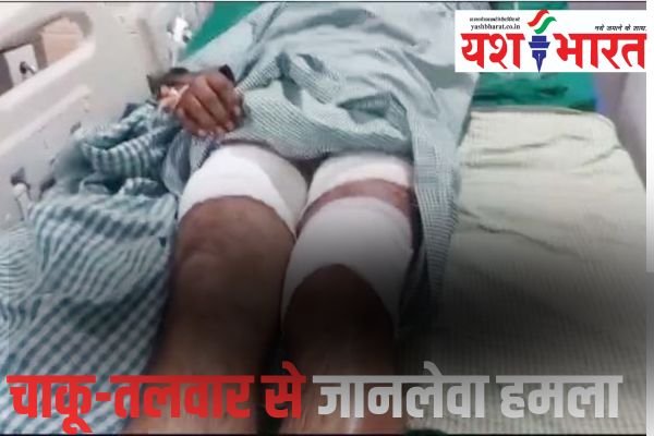 दो युवकों पर बदमाशों ने किया चाकू-तलवार से जानलेवा हमला : एफसीआई गोदाम के पास वारदात 1 Add a heading 42 1