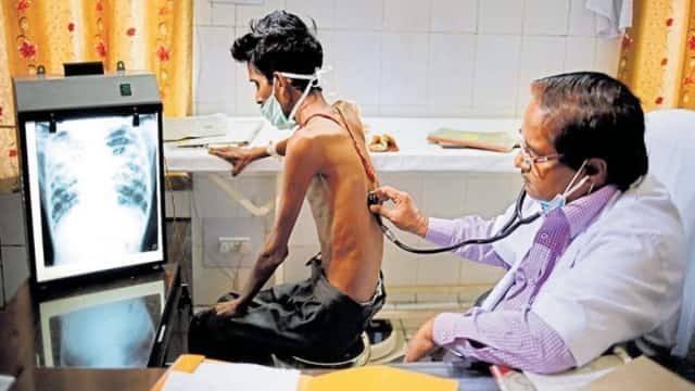 घर-घर सर्वे कर एक वर्ष में चिन्हित किए 1900 टीबी मरीज, 873 लोगों को मिला उपचार 1 images 2024 01 08T111208.278