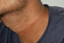 images 2024 04 03T175858.463