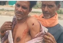 लापरवाही की हदें पार.. कई बार फोन लगाने पर भी नहीं पहुंची एंबुलेंस, लहूलुहान ग्रामीण को परिजन खुद ले गए प्राथमिक स्वास्थ्य केंद्र 9 nbhjjjjjjjjjjjjjjjjjjjjjjjjjjjjjjjjjjjjjjjhjhhhhhhhhhhhhhjhjjjjjjjjjjjjjjjjjjjhjjhjhjh