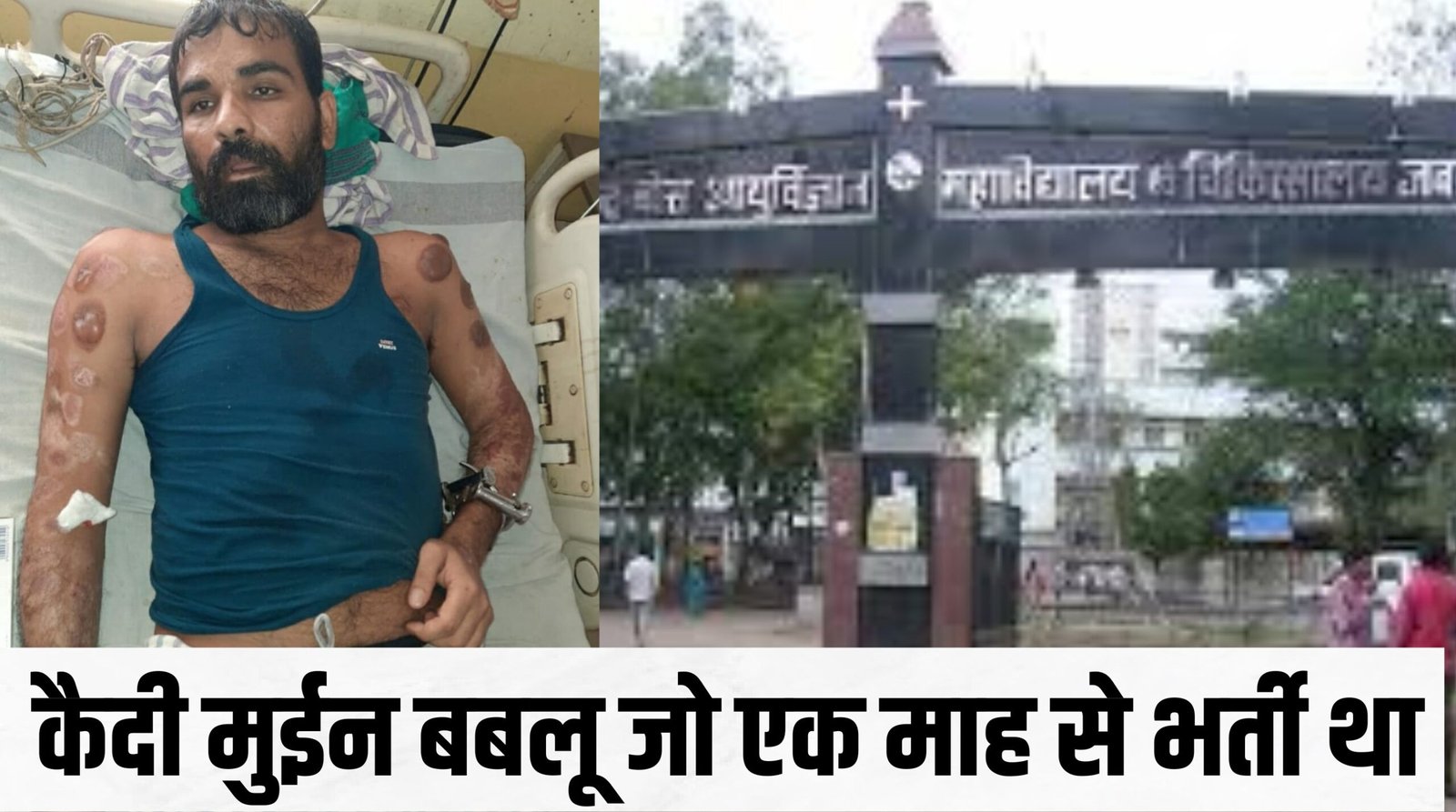 सुबह 4.30 बजे मेडिकल के आईसीयू से भागा कैदी: लगा था लकवा, फिर भी दौड़कर हुआ फरार 3 सड़क हादसे में बच्ची महिला और बाइक सवार की गई जान 1 3 scaled
