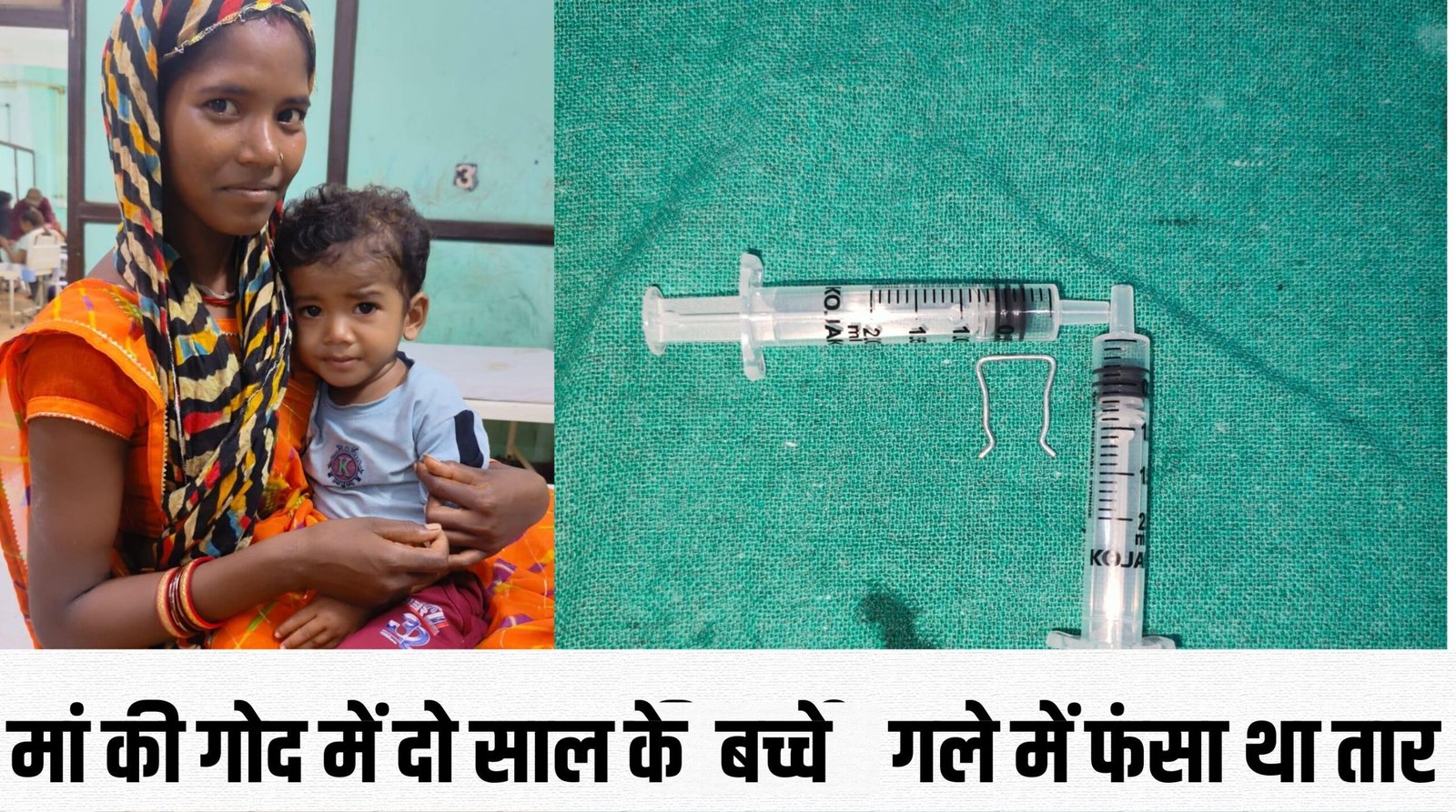 मेडिकल ईएनटी विभागः सुई का धागा समझ 2 साल के बच्चे ने निगल लिया तार का टुकड़ा 2 सड़क हादसे में बच्ची महिला और बाइक सवार की गई जान 17 scaled