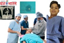 पेपर पिन खाने में कैसे लगती है, निगल गया 10वीं का छात्र: तीन माह से सीने में चुभ रही थी पेपर पिन, दो सप्ताह से कराह रहा था दर्द से 11 Add a heading 68