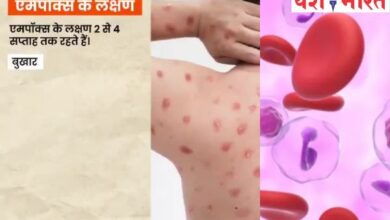 एमपॉक्स को लेकर मिन्स्ट्री आफ हेल्थ ने जारी किया वीडियोः सभी को सावधान रहने की दी सलाह 12 एयर इंडिया का विमान हादसे का शिकार होते होते बचा 41 1