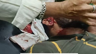 देर रात सिद्धबाबा हनुमान मंदिर में आधा दर्जन युवकों ने मोटर मैकेनिक का काटा कान 7 02