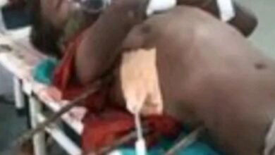 मजदूर के पेट और सीने में घुस गए तीन सरिया : स्टेशन की छत से गिरा श्रमिक, किया गया ऑपरेशन 9 Screenshot 2024 10 30 08 41 08 160 com.miui .gallery