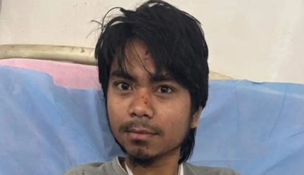 UP के मजदूर पर आतंकियों ने किया हमला, बांह में लगी गोली, हफ्ते भर में तीसरी ऐसी घटना 1 इजरायल की बमबारी से 20 1