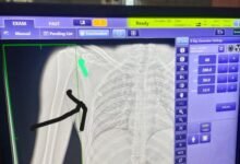 मेडिकल डॉक्टर के रिश्तेदार पर चली गोली , बिटटू ढाबा के पास घटना, सीने में धंसी गोली 11 गांव में न चूल्हे जले न आंसू रुके 20 1