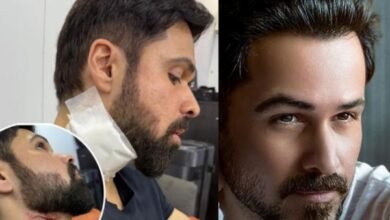 Emraan Hashmi के साथ हुआ बड़ा हादसा, घायल हुए एक्टर, गले से निकला खून 9 गांव में न चूल्हे जले न आंसू रुके 36