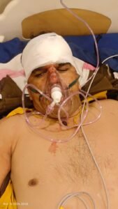 बांदकपुर चौकी प्रभारी का ट्रेन से हाथ कटा, कॉन्स्टेबल गंभीर, जबलपुर के मेट्रो अस्पताल में चल रहा है इलाज 2 IMG 20241111 WA0001