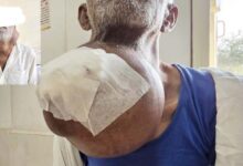 इजरायल की बमबारी से 44