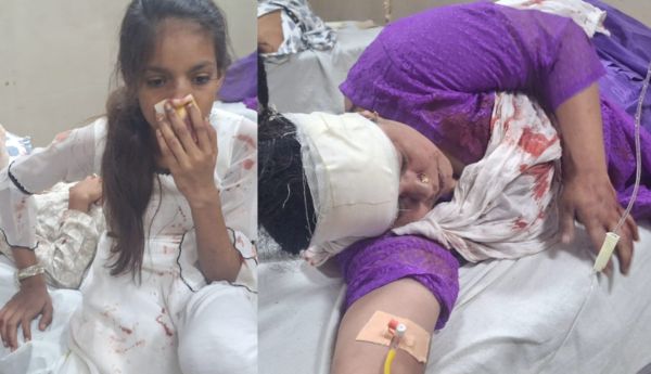 इजरायल की बमबारी से 51