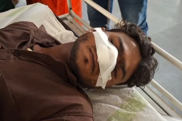 दांतों से काट डाली नाक... इतनी सी बात और सनकियों ने दे दी खौफनाक सजा 1 गांव में न चूल्हे जले न आंसू रुके 14