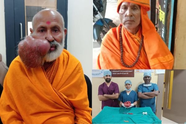 बड़ेरिया मेट्रोप्राइम हॉस्पिटल में चेहरे के 3 किलो के ट्यूमर का हुआ सफल ऑपरेशन 1 गांव में न चूल्हे जले न आंसू रुके 23