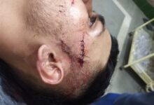 WhatsApp Image 2025 04 06 at 6.23.27 AM