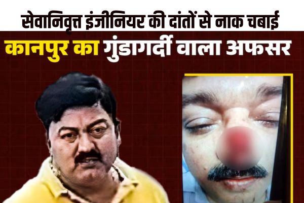 सेवानिवृत्त इंजीनियर की दांतों से नाक चबाईः पार्किंग को लेकर विवाद, गाड़ी मालिक की करतूत... वीडियो... देखें.... 1 40