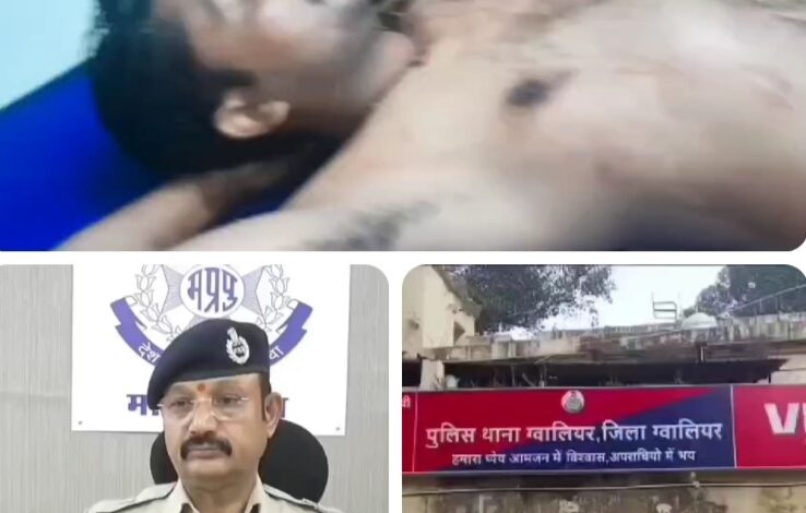 गोलीकांड से हड़कंप : राजीनामा नहीं किया तो दो बदमाशों ने मिलकर युवक को कर दिया शूट 1 IMG 20250609 183317