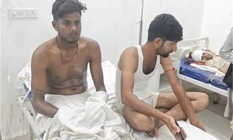 राजगढ़: कार-बाइक की टक्कर के बाद हुए विवाद में 6 लोगों पर एसिड अटैक, 1 Untitled 5 copy 3