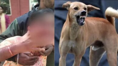 कोर्ट परिसर में आवारा कुत्ते का हमला: महिला गंभीर रूप से घायल, भीड़ ने ली कुत्ते की जान 7 Untitled 6 copy