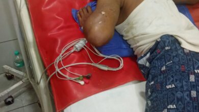 दुर्गा पंडाल का सामान जमाते दो युवकों को करंट लगा, गंभीर रूप से घायल 6 8e977e60 c6df 4b90 868c d7cd5434e21f