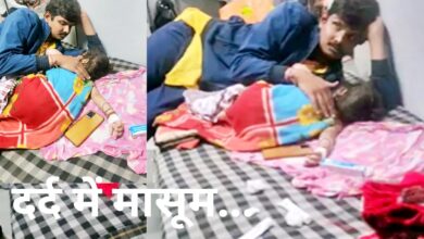 समोसे की खोलती कढ़ाई में गिरा दो साल का बच्चा, 11 Untitled 7 copy 6