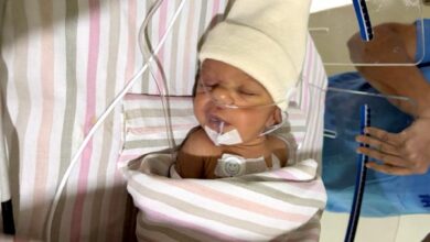 सिहोरा की मासूम मुंबई में हुई स्वस्थ्य: 5 घंटे की जटिल सर्जरी के बाद मिला जीवनदान 7 014 5