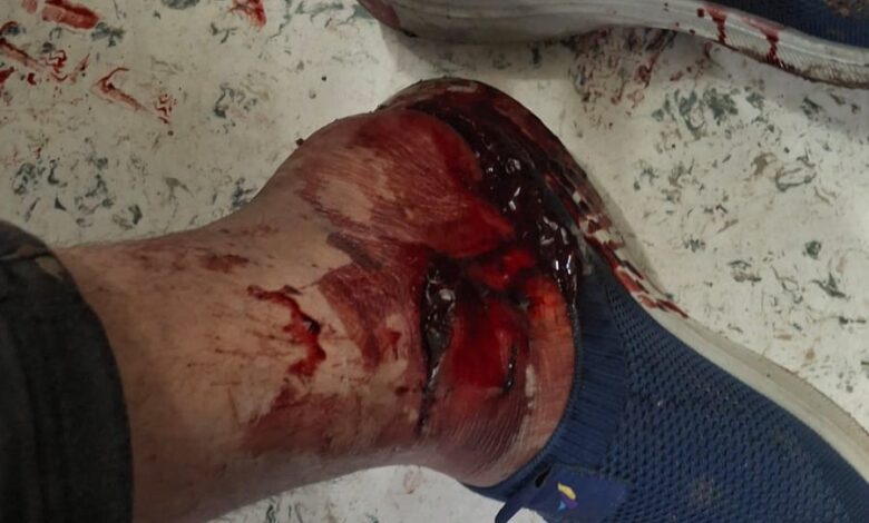 0a3cd0c3 f102 41ce 82b0 42ae4f8aad3d